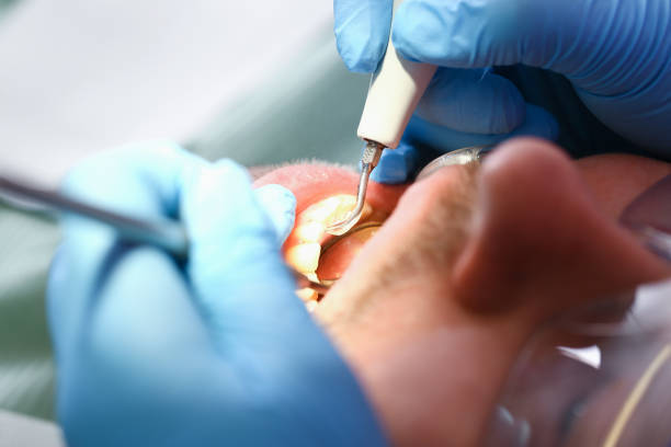 Best Emergency Dental Care for Abscessed Tooth in Sistersville, WV