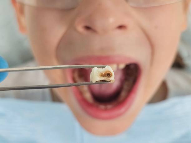 Best Holiday Emergency Dentist in Sistersville, WV